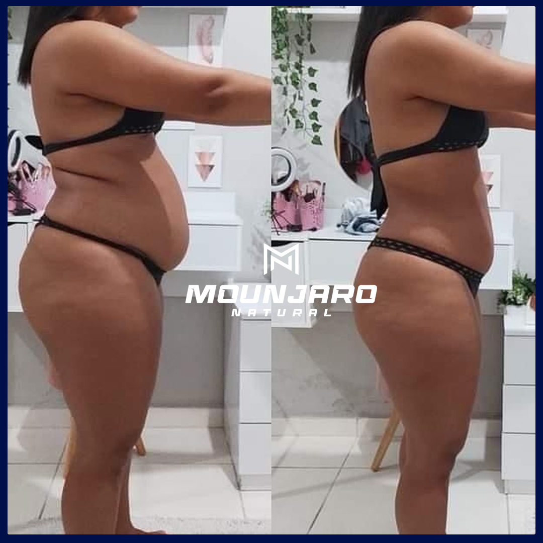 antes e depois 03